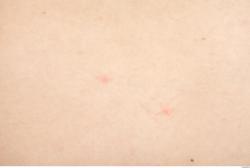 Photo Textures of Human Skin